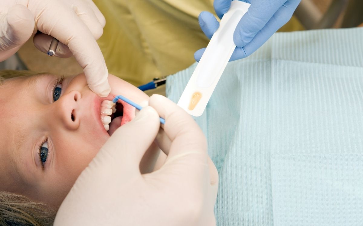 Featured image for “The Importance of Fluoride for Kids’ Teeth”
