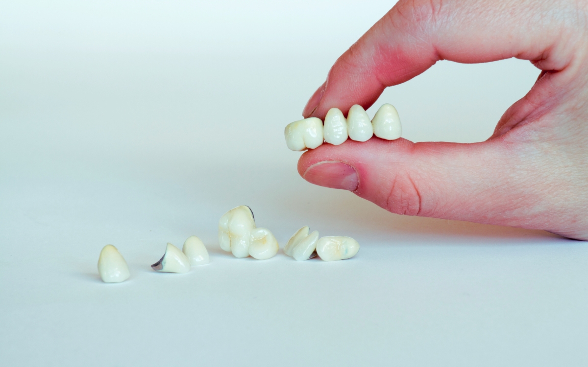 Featured image for “Can Crowns Be Done in One Day?”