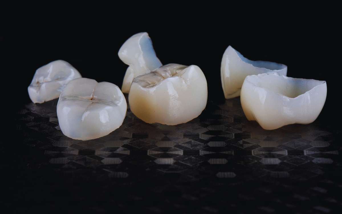 Featured image for “Can Same-Day Crowns Be Applied to Front Teeth?”