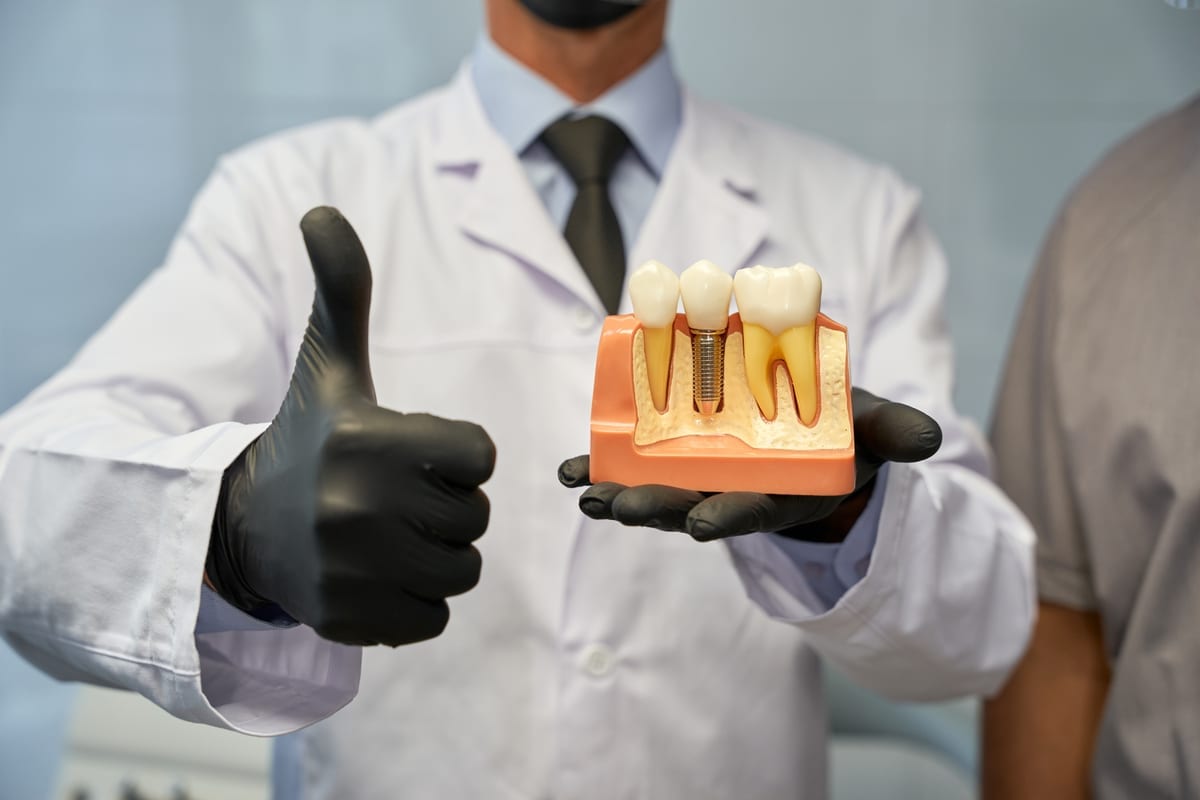 Dental Implants in Mesa